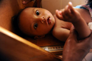 A seven-month old girl in the Madagascan capital of Antananarivo being measured to check her recovery from acute malnutrition at the outpatient clinic, Centre de recuperation et de l'education nutritionelle en ambulatoir. Photo:Guy Oliver/IRIN &nbsp;