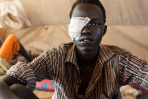 Lat Padang, a soldier with the opposition army in South Sudan, with a patch over his eye, at a hospital in Bentiu after being wounded in battle.  Photo:  Lynsey Addario/ New York Times 